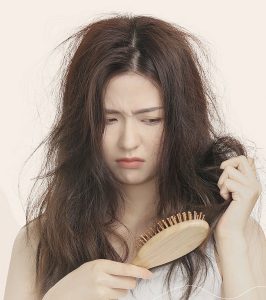 Rụng tóc nhiều ở nữ