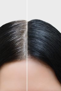 Rụng tóc bổ sung gì